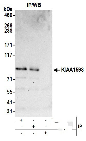 shootin-1 Antibody