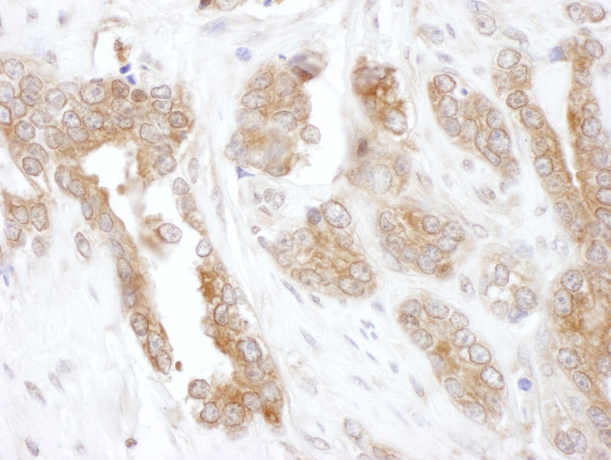 CCT5 Antibody