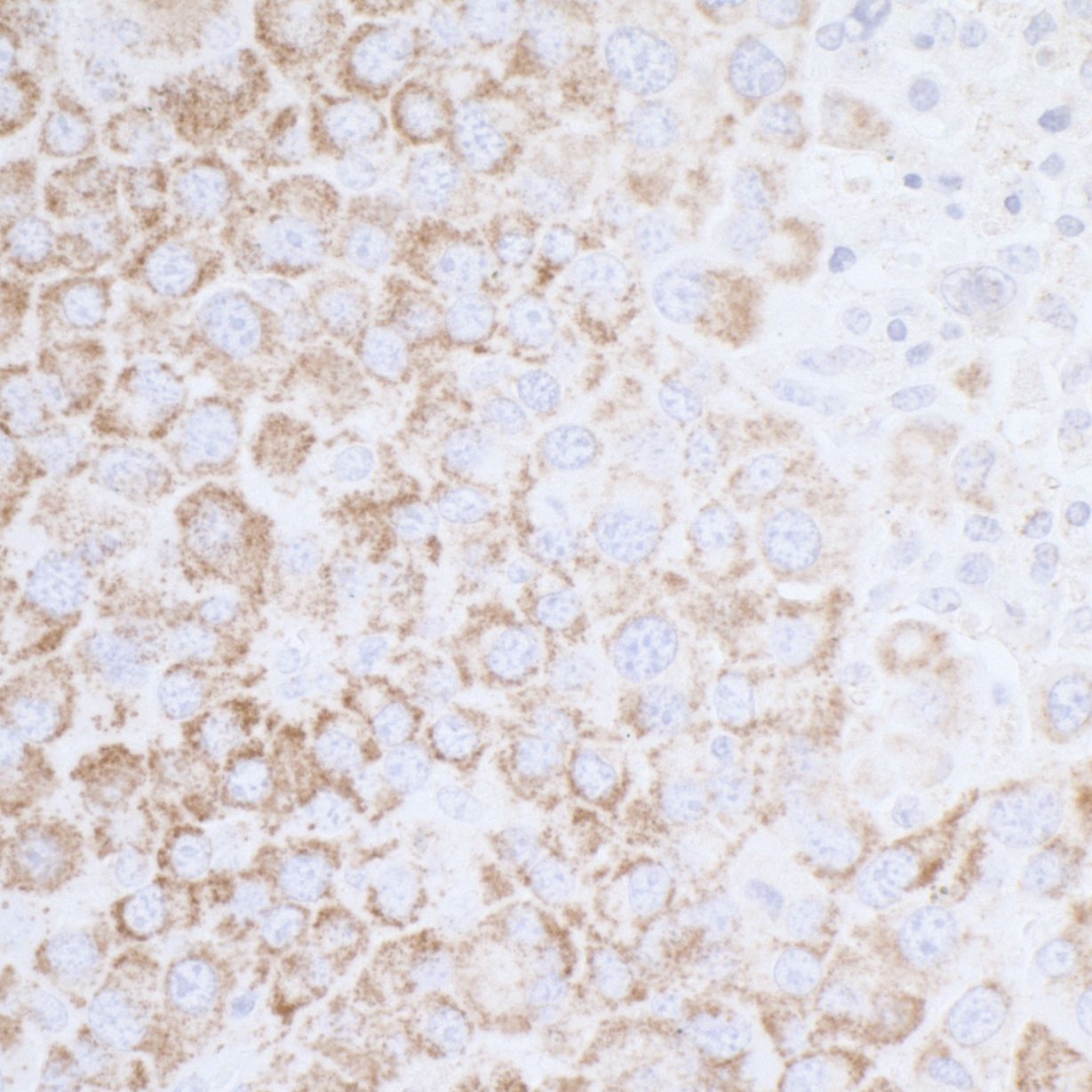 ATP5A Antibody
