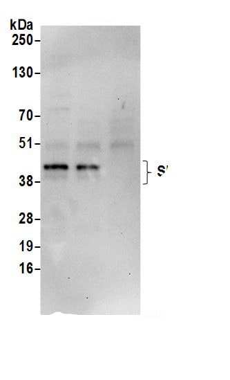 SNURPORTIN1 Antibody
