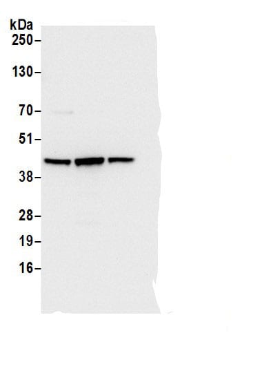 Adenosine Deaminase/ADA Antibody