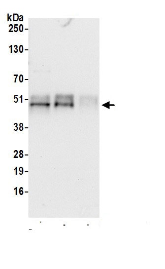 TC-PTP/PTPN2 Antibody