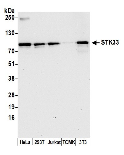STK33 Antibody