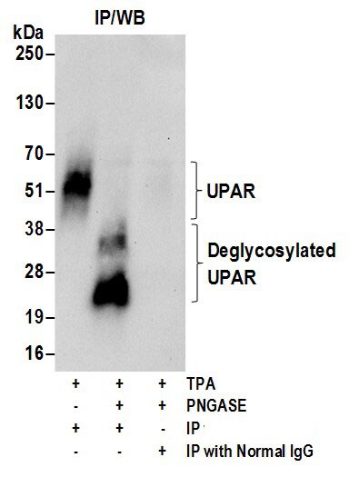 uPAR Antibody