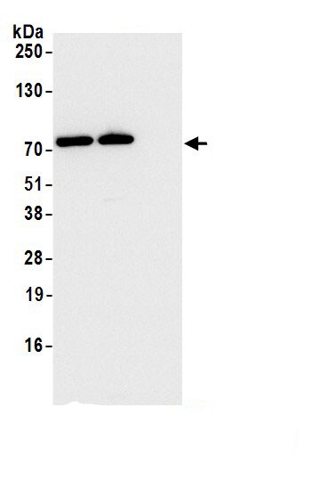 CCDC22 Antibody