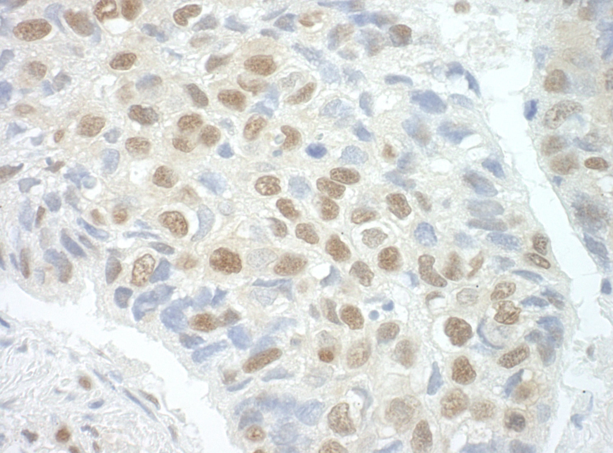 POGZ Antibody