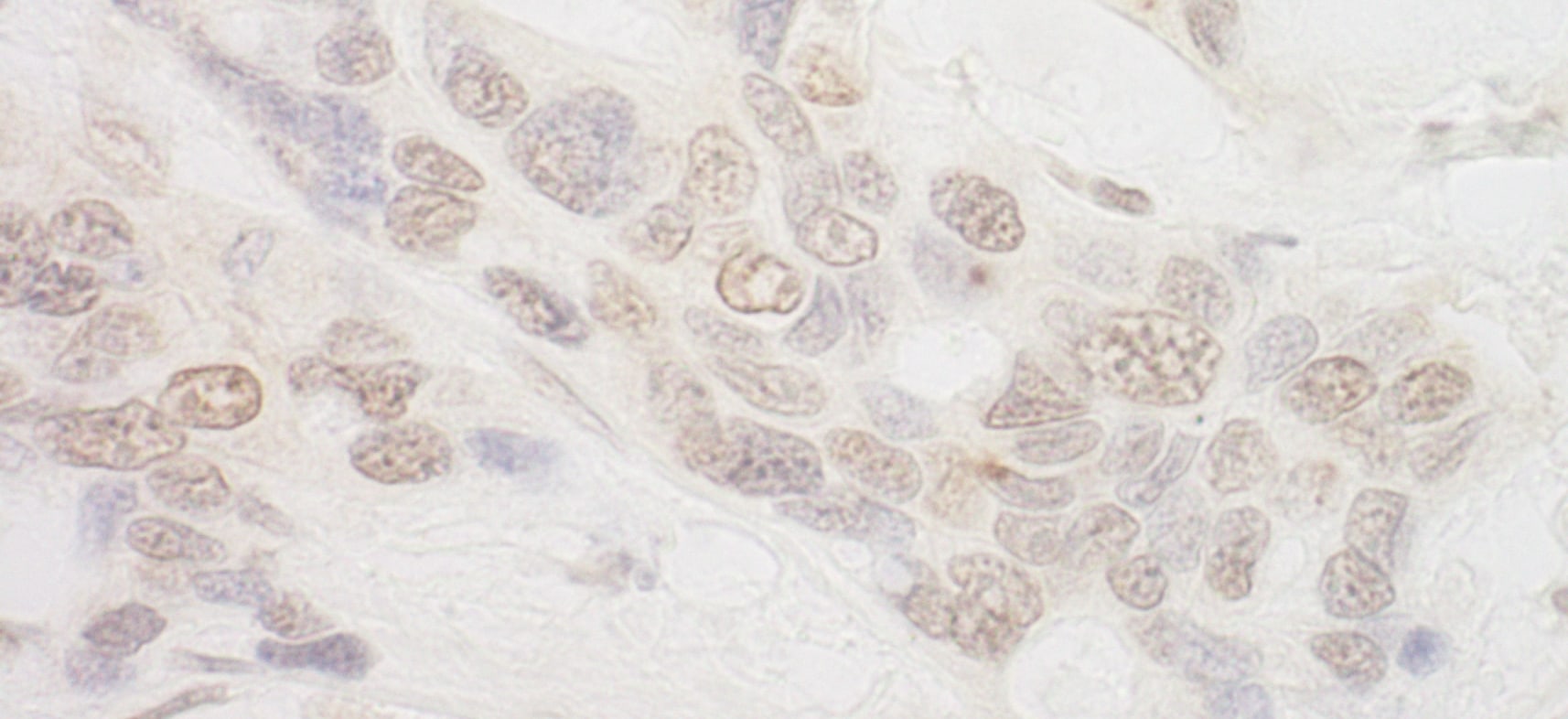 Intron-Binding Protein Of 160 KDa Antibody