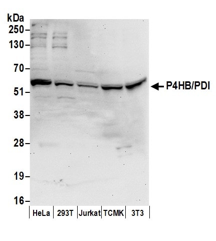 Protein Disulfide Isomerase/P4HB Antibody