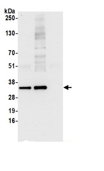 ARPC2 Antibody