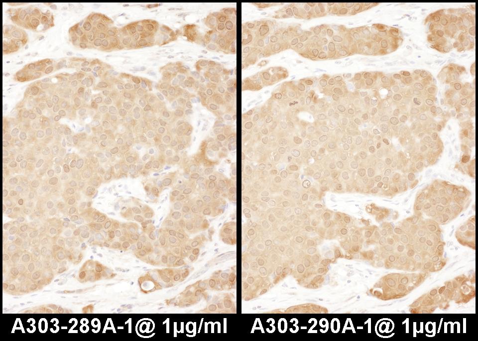 LASP1 Antibody