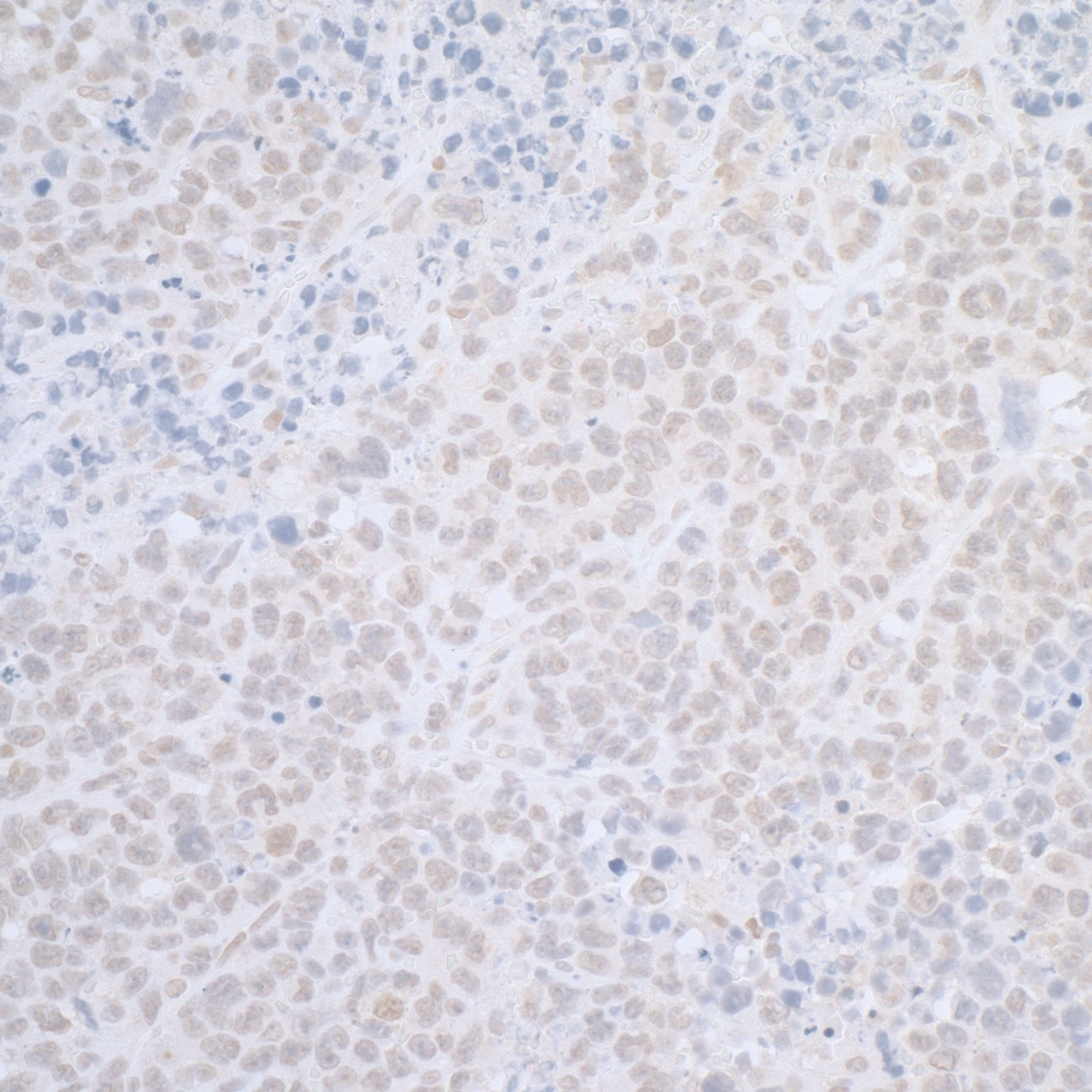 ELAC2 Antibody