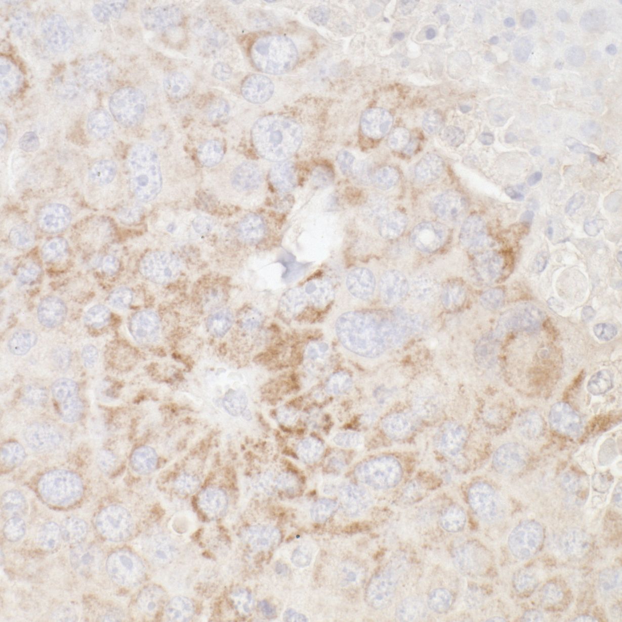 ATP5A Antibody