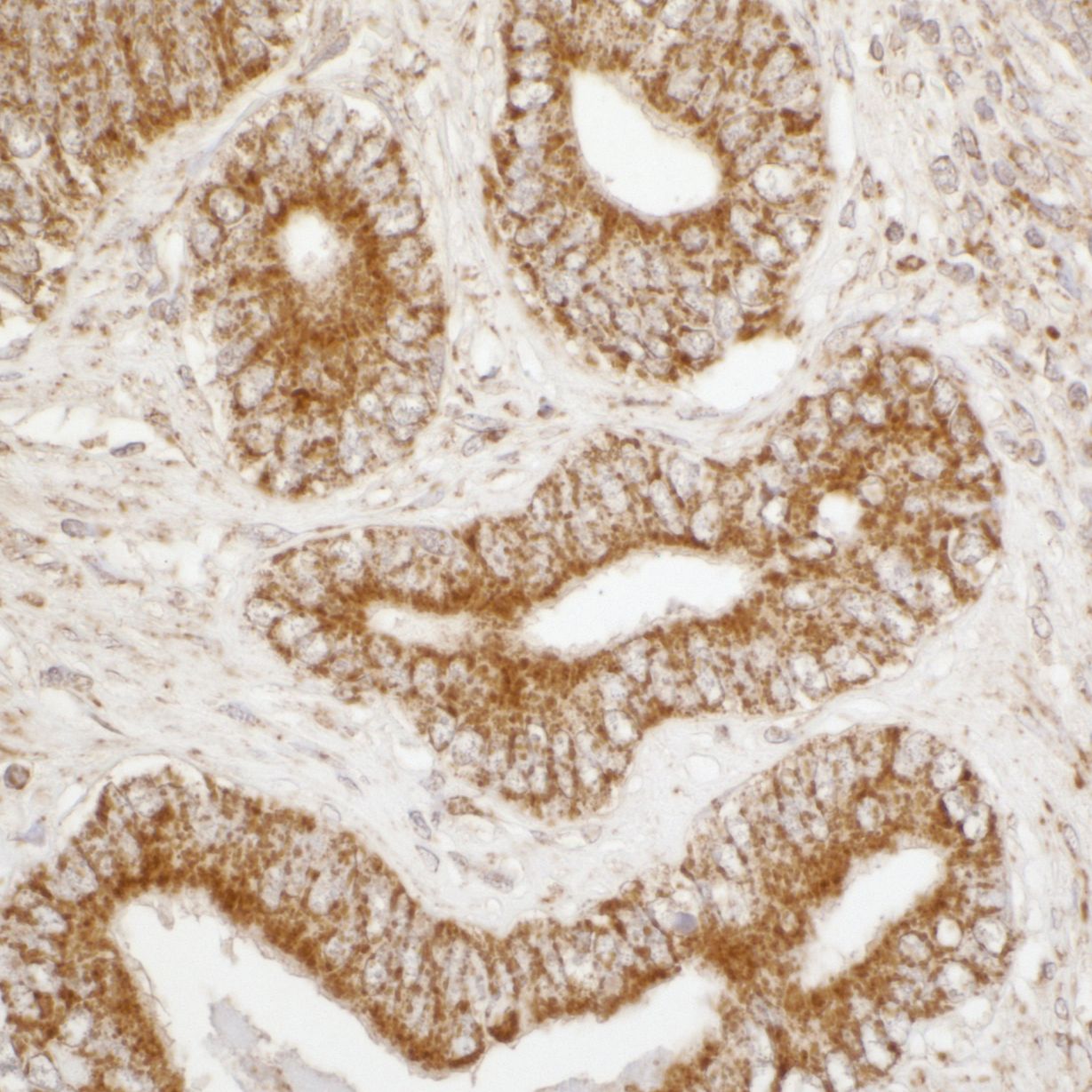 ATP5A Antibody