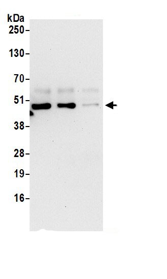 P2X5/P2RX5 Antibody
