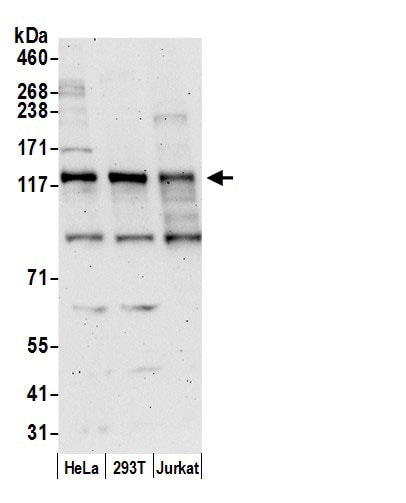 AFTPH Antibody