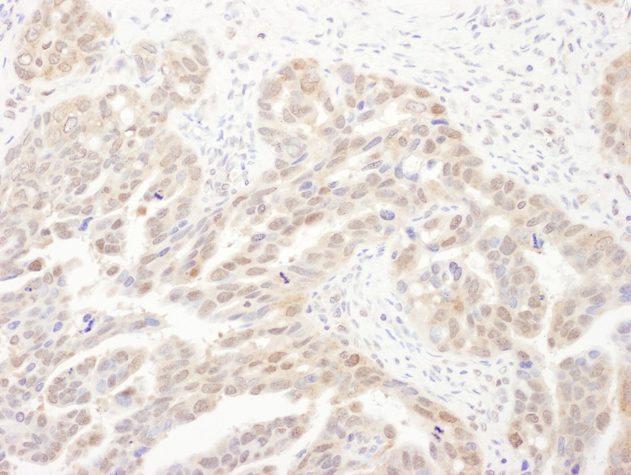 Proteasome 20S alpha 6 Antibody