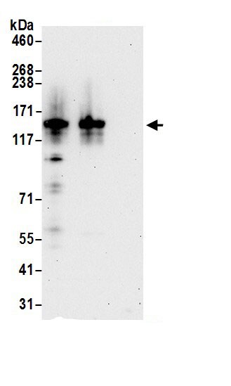 ADAR Antibody
