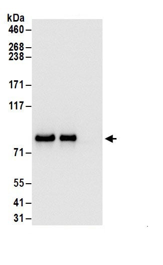Glycogen Synthase Antibody