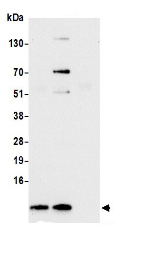 RPS28 Antibody
