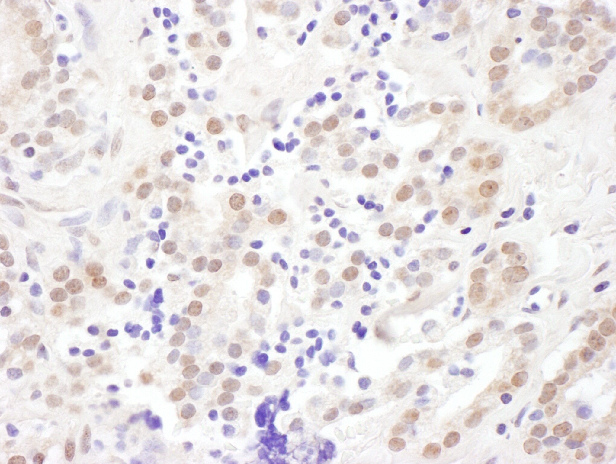 Exosome component 10 Antibody