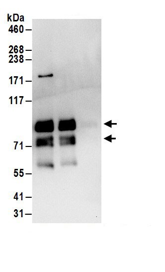MEPCE Antibody