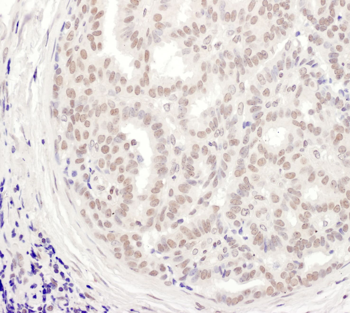 MEPCE Antibody