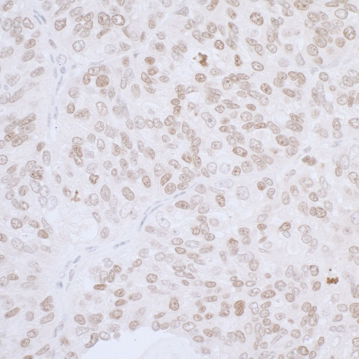 Thymopoietin/LAP2 Antibody