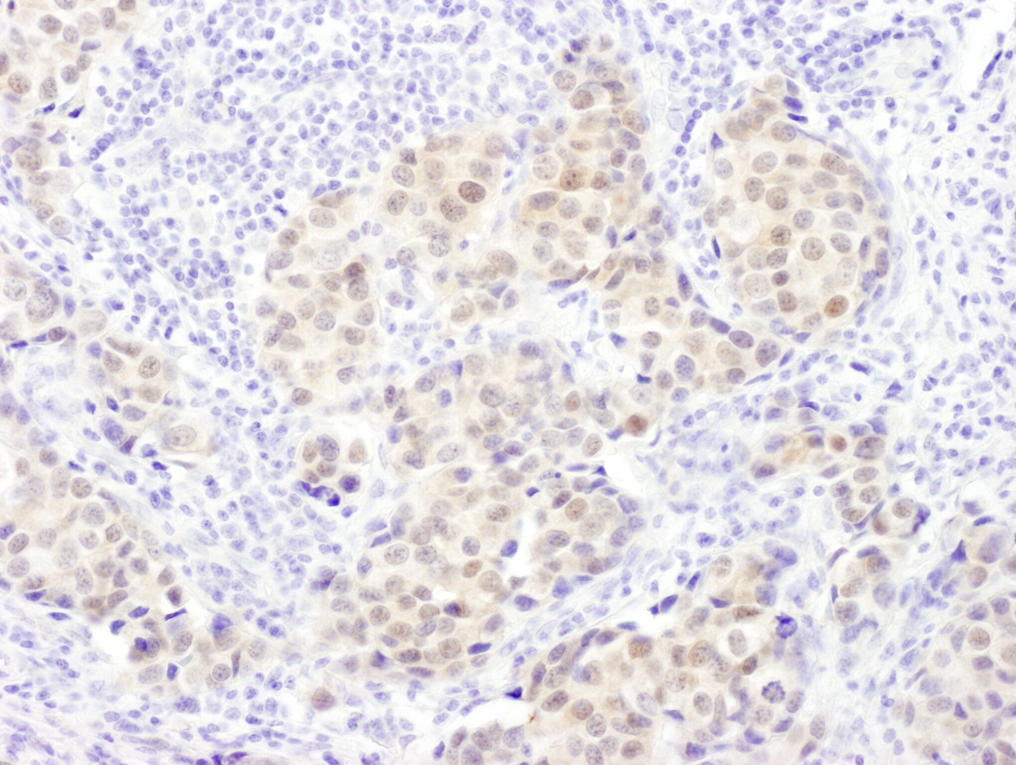 PSMB5 Antibody