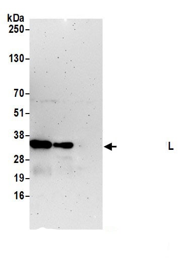 MAPK1IP1L Antibody