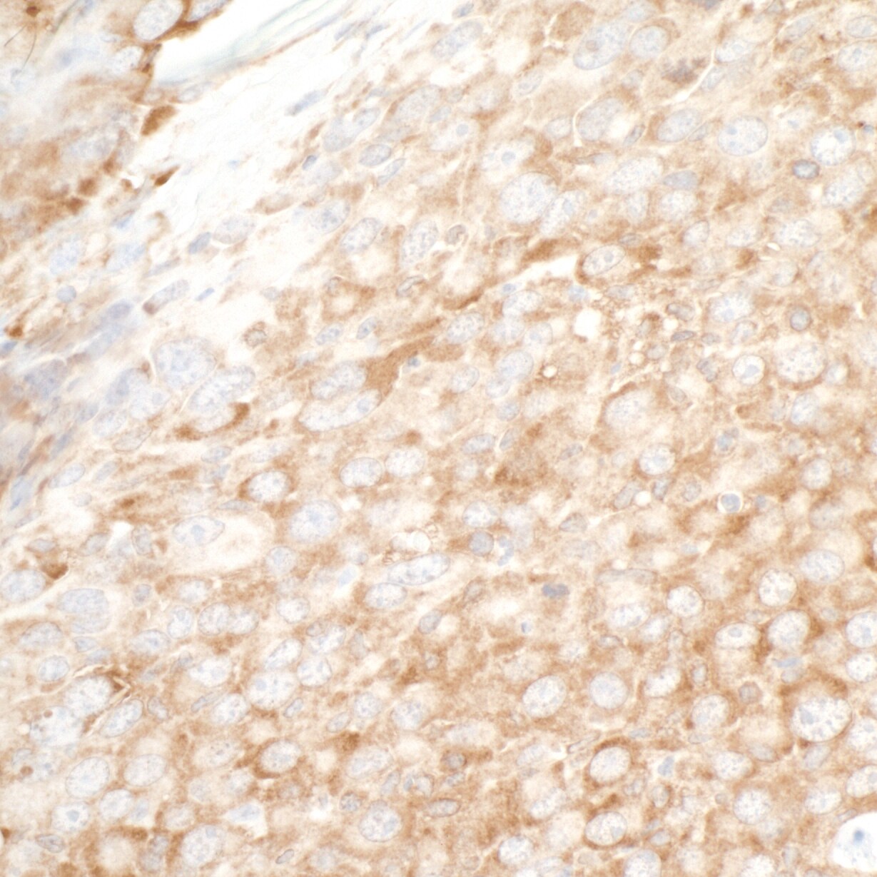 YB1 Antibody