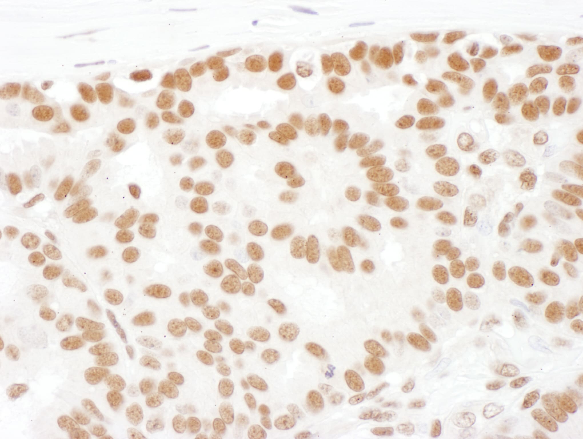 Splicing Factor 1 Antibody