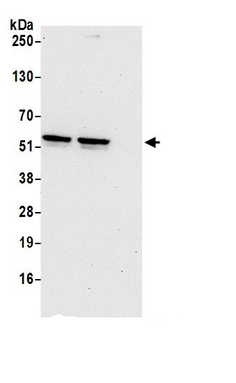 TSPYL1 Antibody