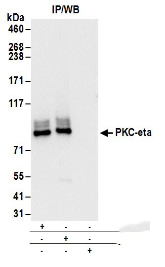 PKC eta Antibody