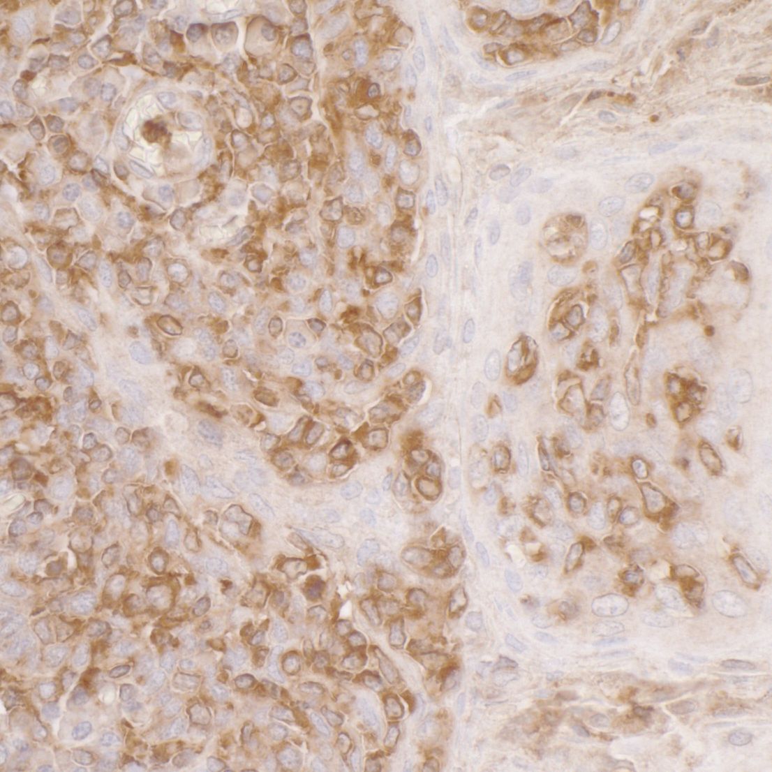ACTR2 Antibody