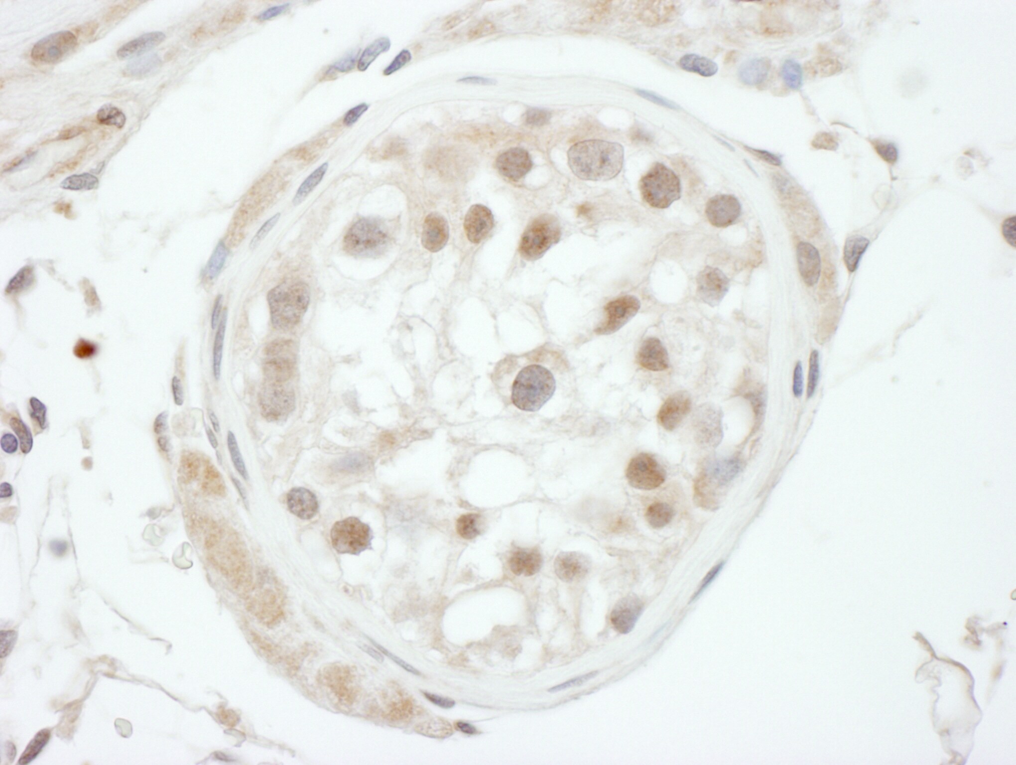GTF2H1 Antibody