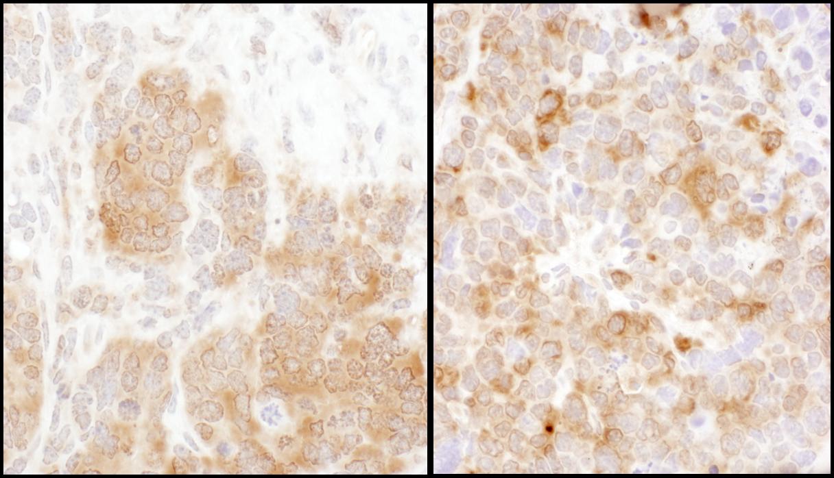 Thymidylate Synthase Antibody