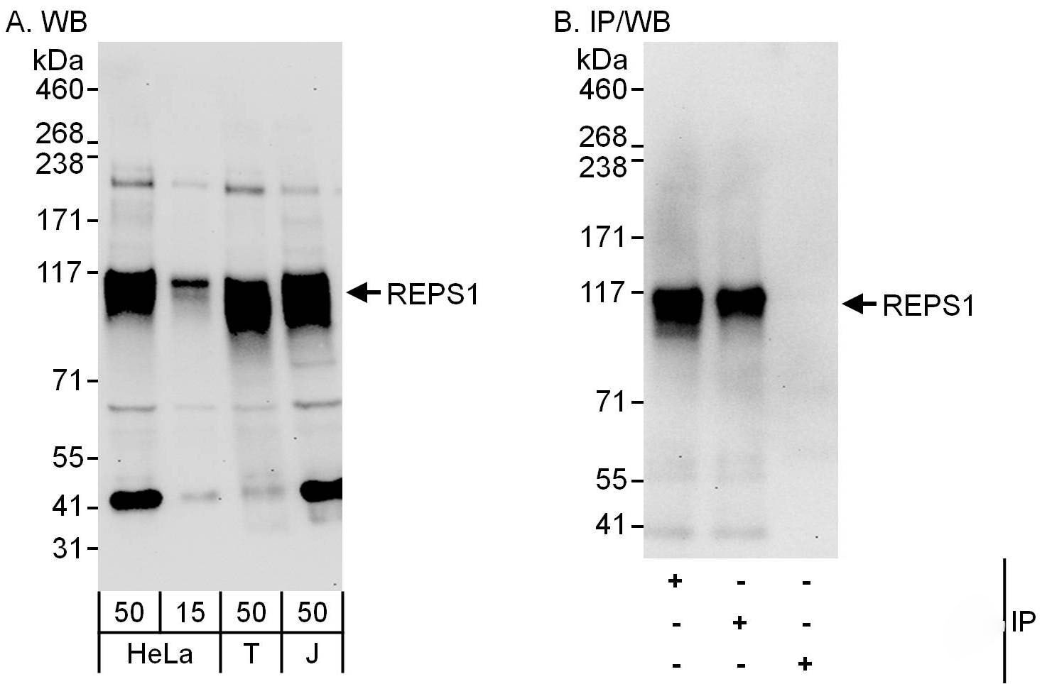 REPS1 Antibody