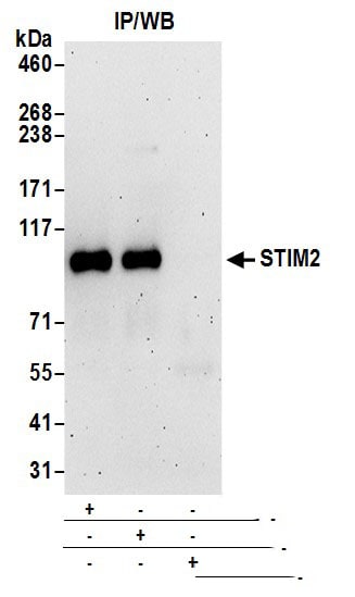 STIM2 Antibody