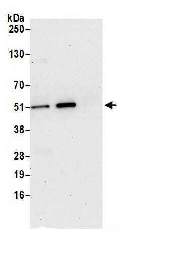 PGD Antibody