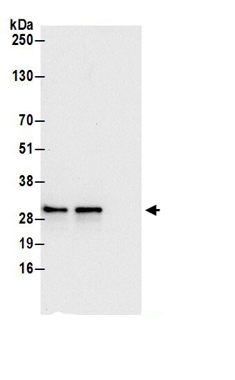 SRPRB Antibody