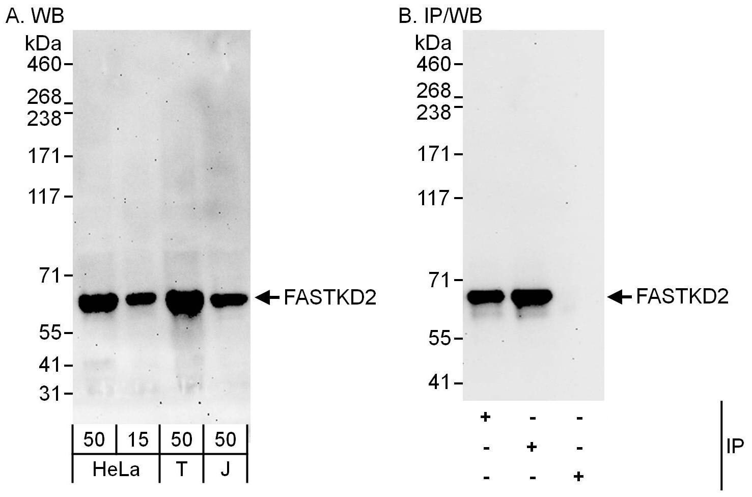 FASTKD2 Antibody