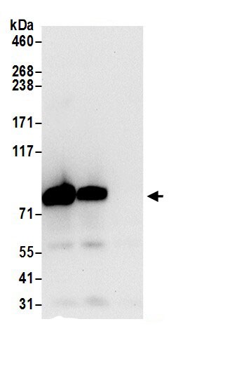 TARS Antibody