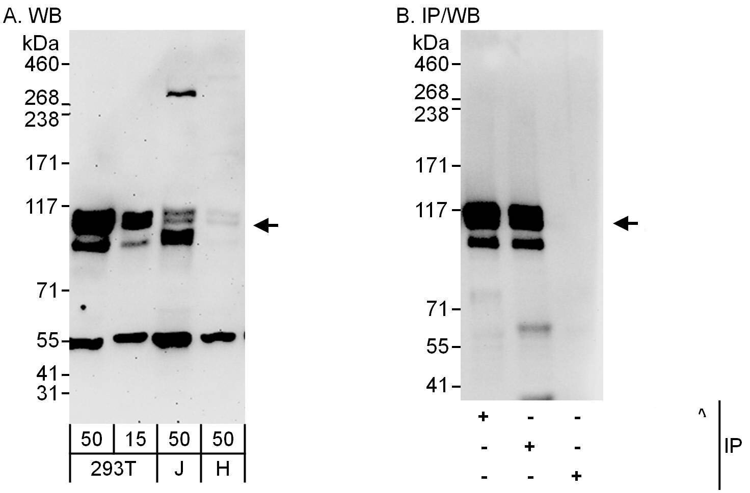 SKI Antibody