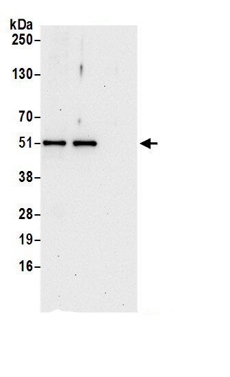 ETEA Antibody