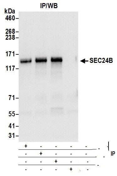 SEC24B Antibody
