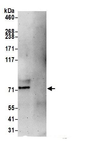 Proprotein Convertase 9/PCSK9 Antibody