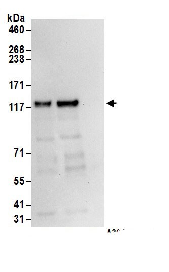 ROR2 Antibody