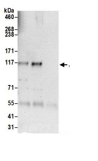 FGD1 Antibody
