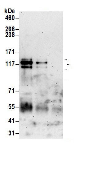 CLCN7 Antibody