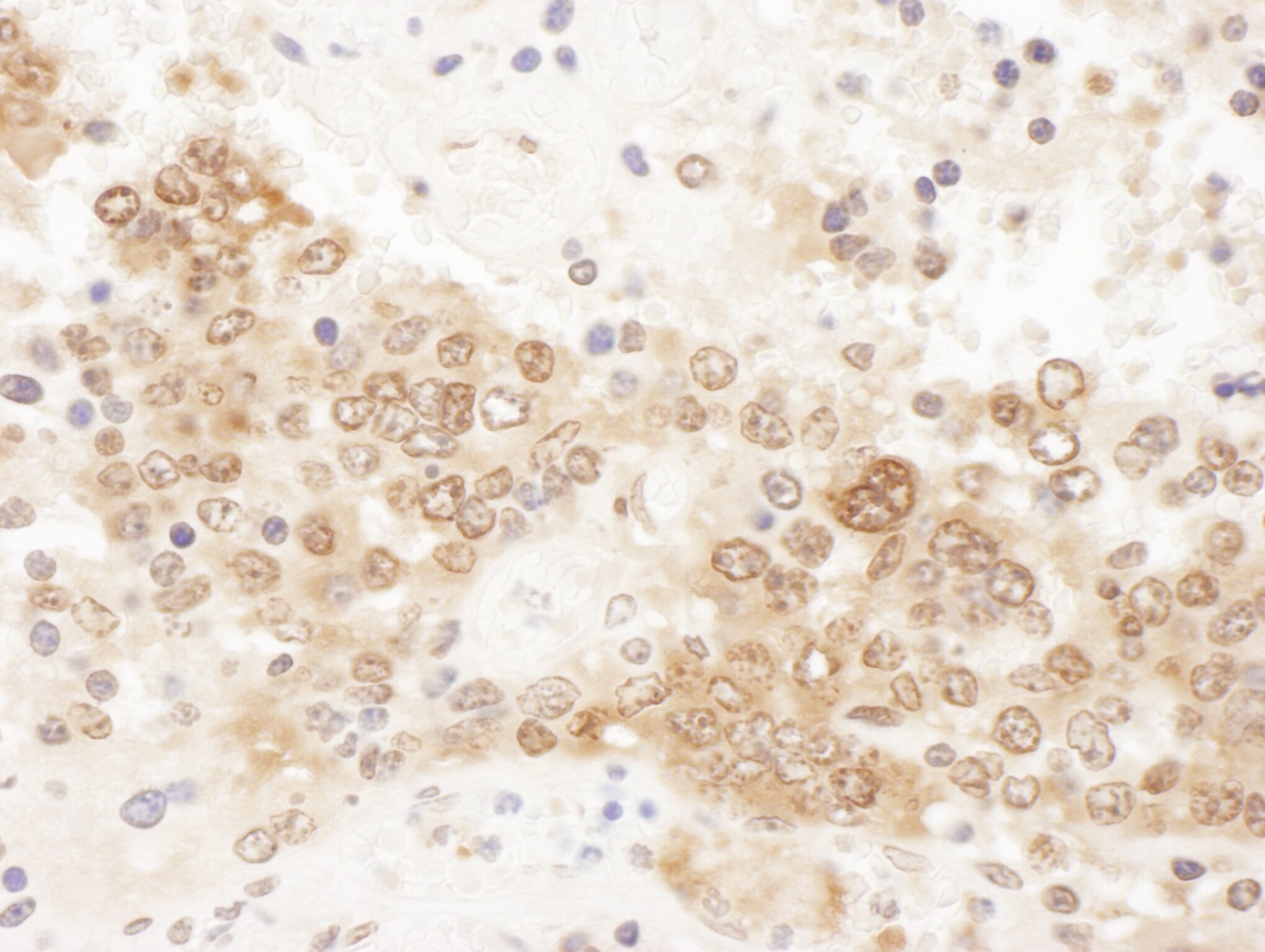 CLNS1A Antibody